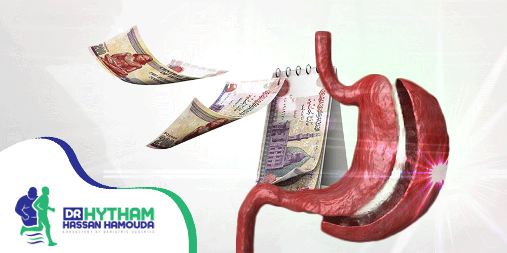 سعر عملية تكميم المعدة