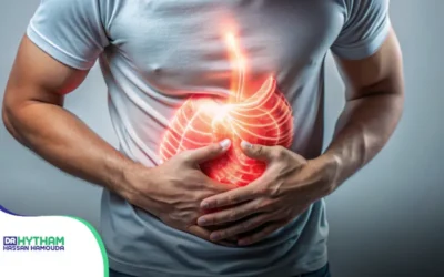 متى تكون أعراض فتق الحجاب الحاجز أكثر من مجرد حموضة عابرة؟
