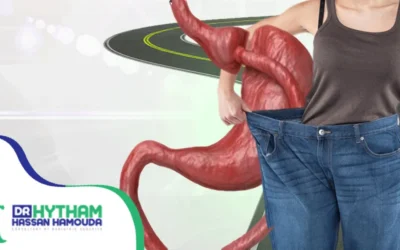 عملية تحويل مسار المعدة