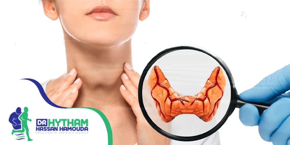 علاج تضخم الغدة الدرقية بدون جراحة